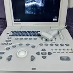 УЗИ УЗД аппарат SonoScape SSI-1000/ Соноскейп/ Доплер PW/ Линейный